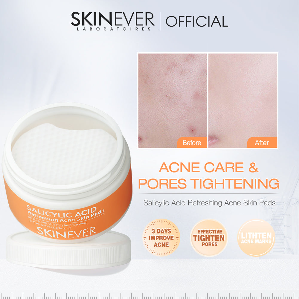 Skinever Salicylic Acid Acne Skin Pads