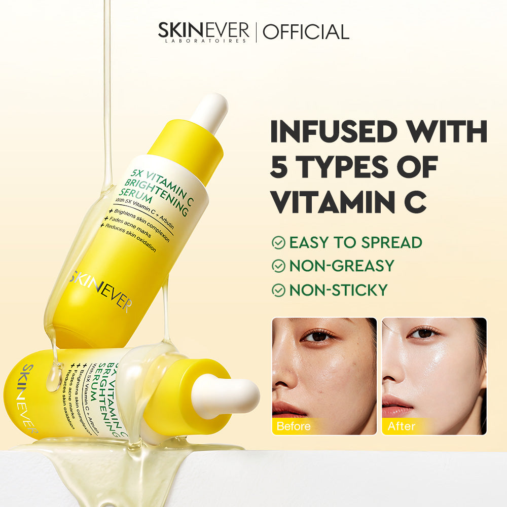 Skinever 5X Vitamin C Brightening Serum bottle