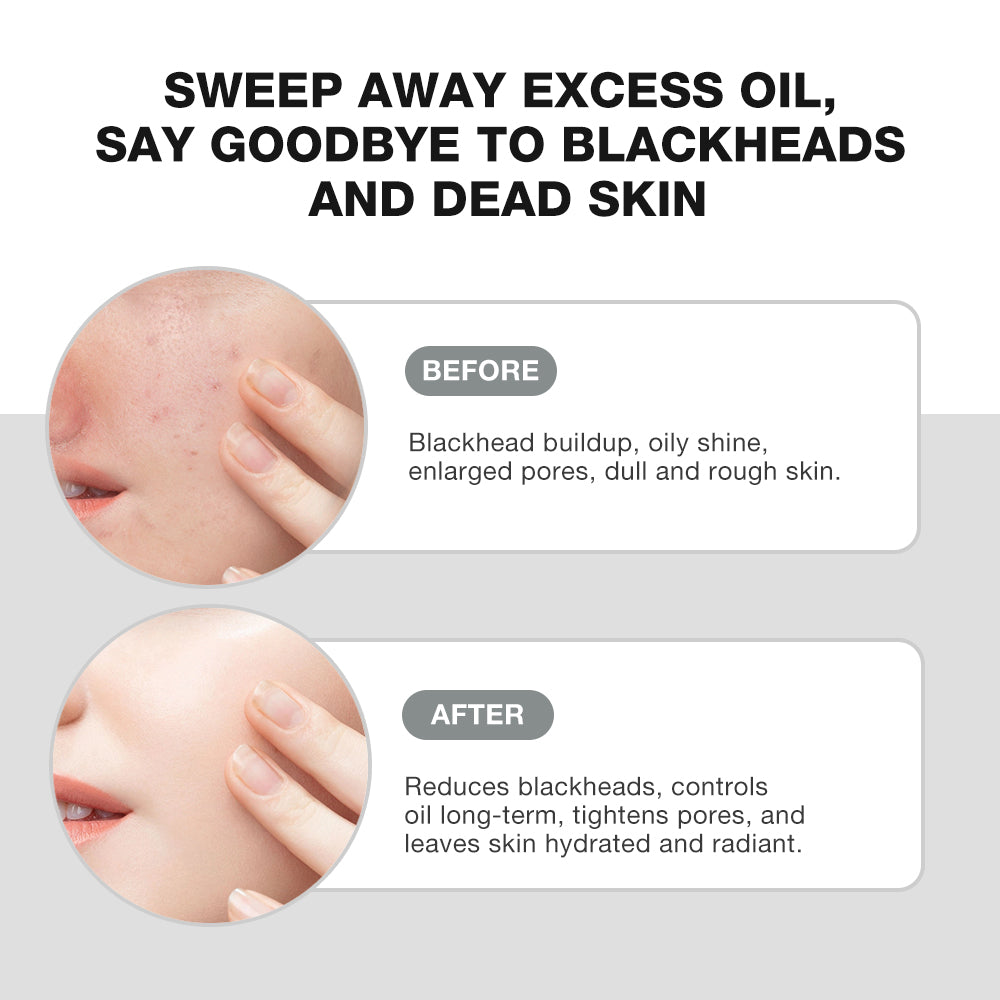 SKINEVER Salicylic Acid Mud Mask – Deep Cleansing & Oil Control Mask for Pores UAE