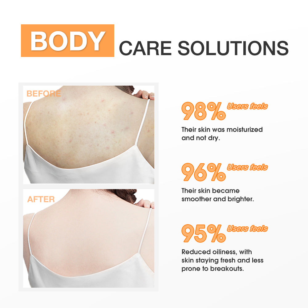 SKINEVER Salicylic Acid Body Lotion – Exfoliating, Lightweight, Smoothing for KP & Rough Skin UAE