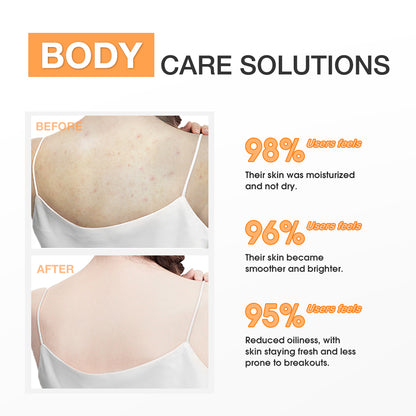 SKINEVER Salicylic Acid Body Lotion – Exfoliating, Lightweight, Smoothing for KP & Rough Skin UAE