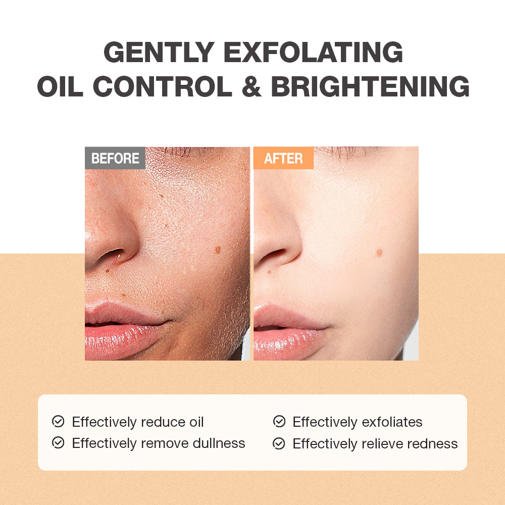 SKINEVER Salicylic Acid Scrub Cleanser – Gentle Exfoliating Cleanser UAE