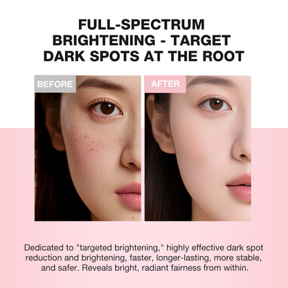 SKINEVER 10% Niacinamide Dark Spot Care Cream – Brightening & Oil Control Moisturizer UAE