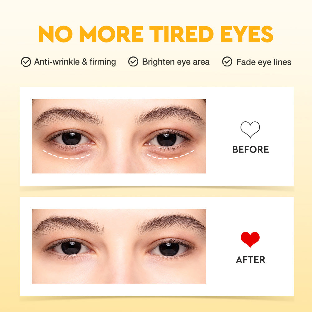 Skinever 5X Vitamin C Eye Cream