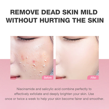 SKINEVER 3% Niacinamide Whitening Gel – Exfoliating Brightening Gel UAE