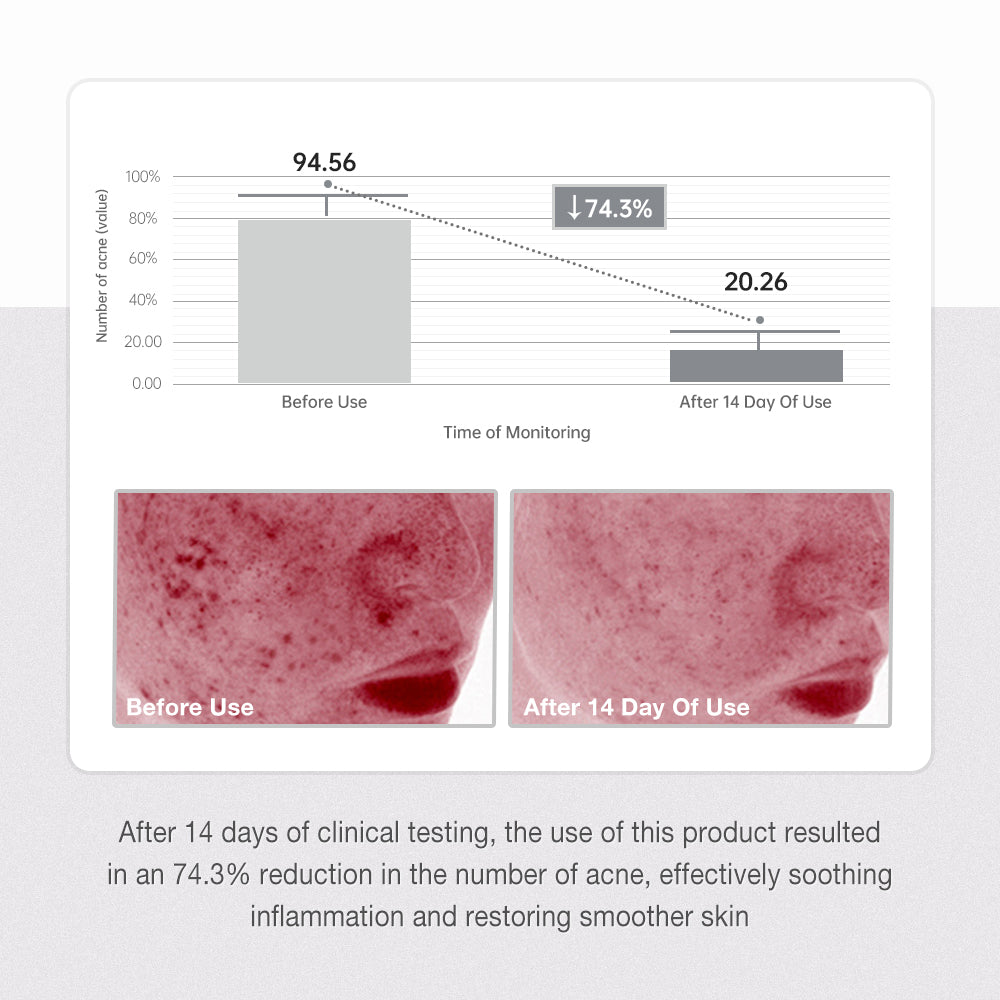 SKINEVER Salicylic Acid Anti-Acne Serum – Pore Refining & Spot Treatment UAE