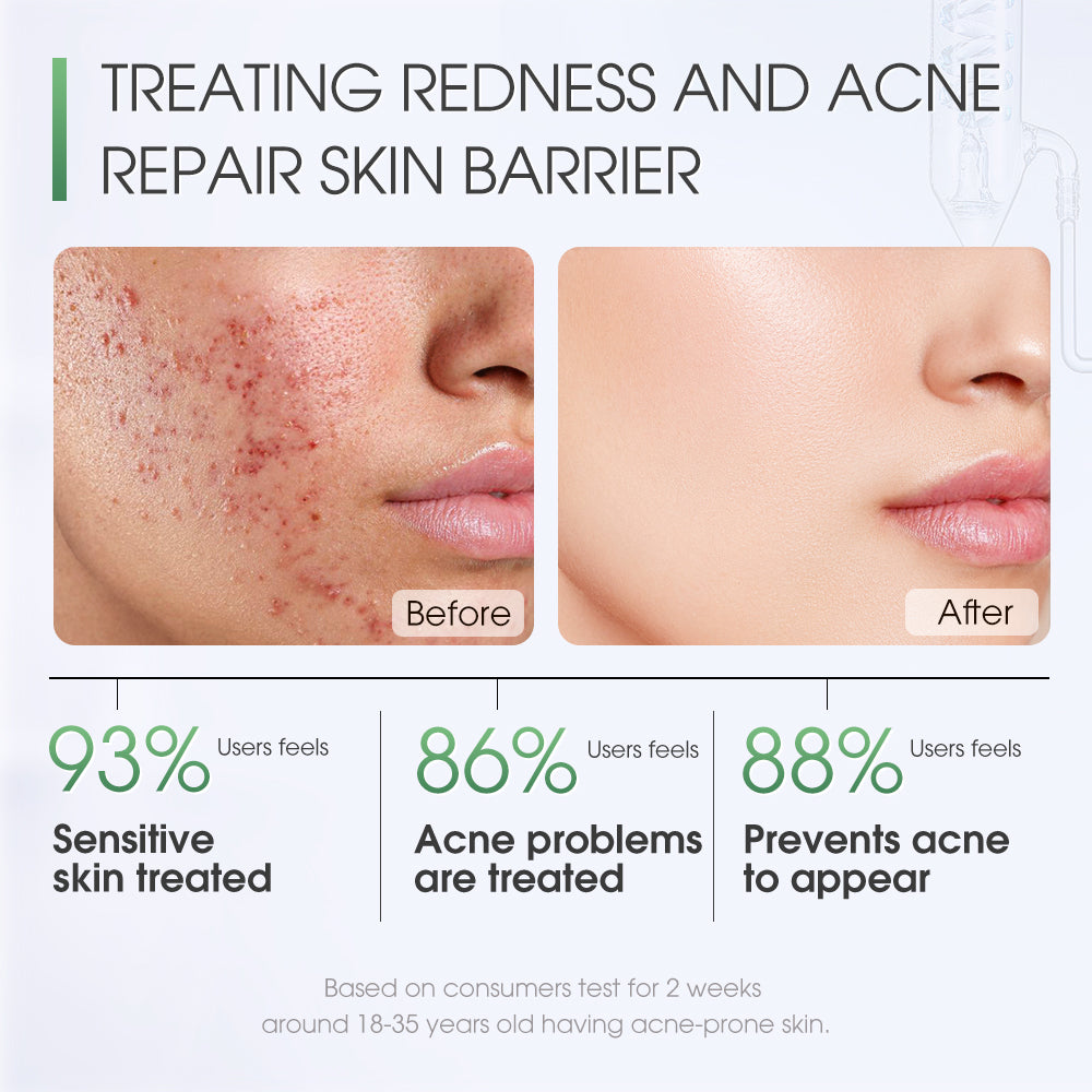 SKINEVER Redness Relief Mask – Centella Soothing Sheet Mask for Sensitive Skin UAE