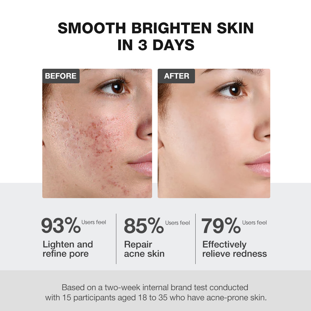 SKINEVER Salicylic Acid Mud Mask – Deep Cleansing & Oil Control Mask for Pores UAE