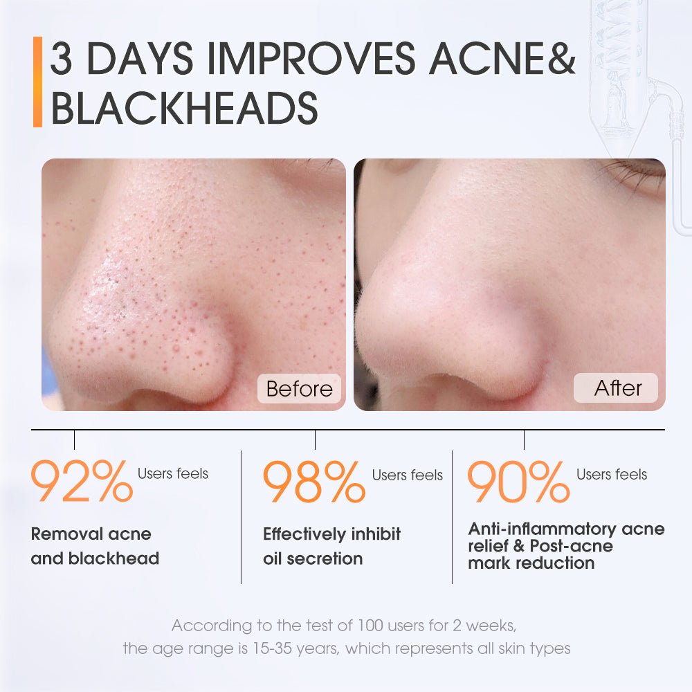 Skinever Salicylic Acid Acne Skin Pads