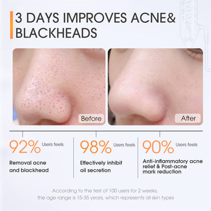 Skinever Salicylic Acid Acne Skin Pads