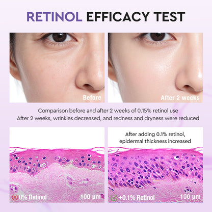 Skinever 3A Retinol Collagen Brightening Soap