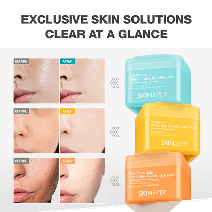 SKINEVER Vitamin C Brightening Toner Pads – Radiance Boosting Toner Pads for Glowing Skin UAE