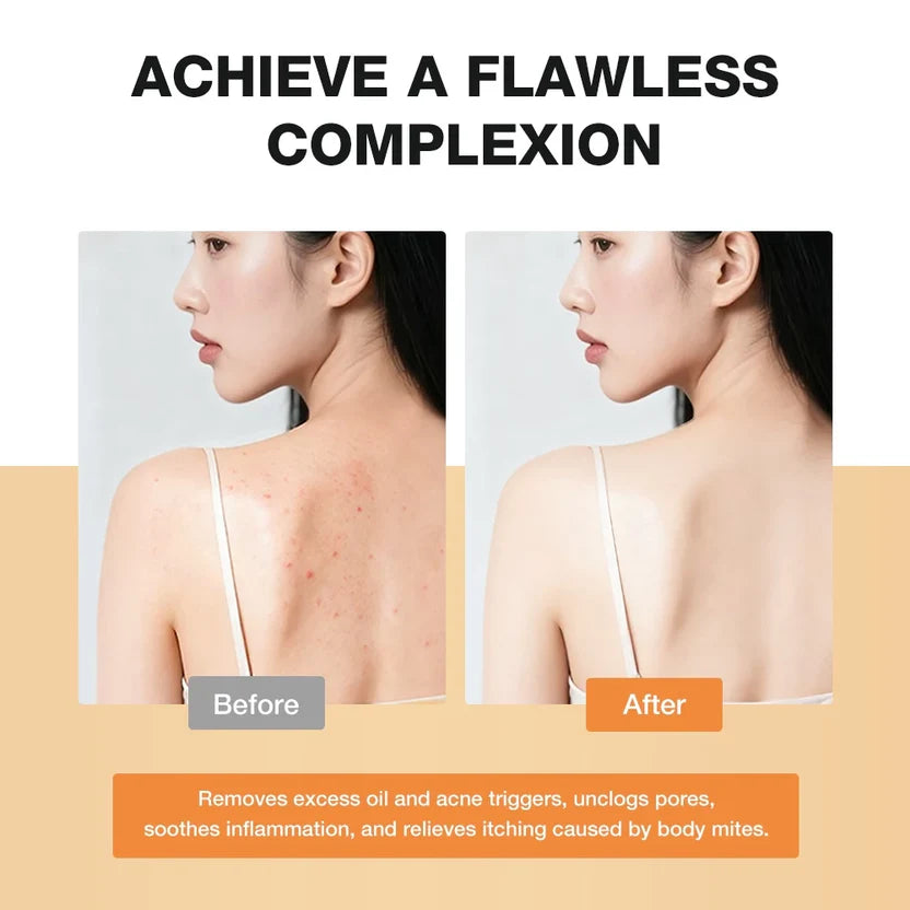 SKINEVER Salicylic Acid Refreshing Antibacterial Body Wash – Deep Cleansing Body Cleanser UAE