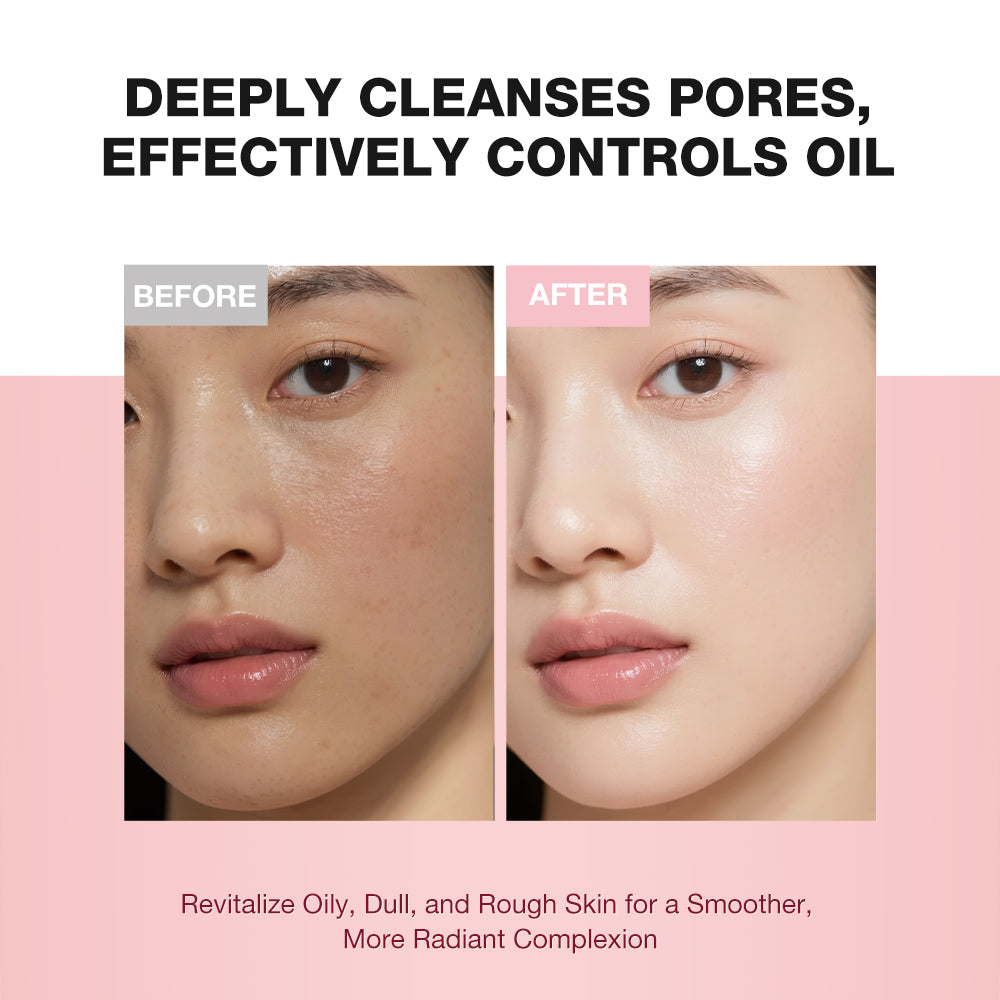 SKINEVER Niacinamide Brightening Deep Clean Scrub Cleanser – Exfoliating & Pore Refining Face Wash UAE