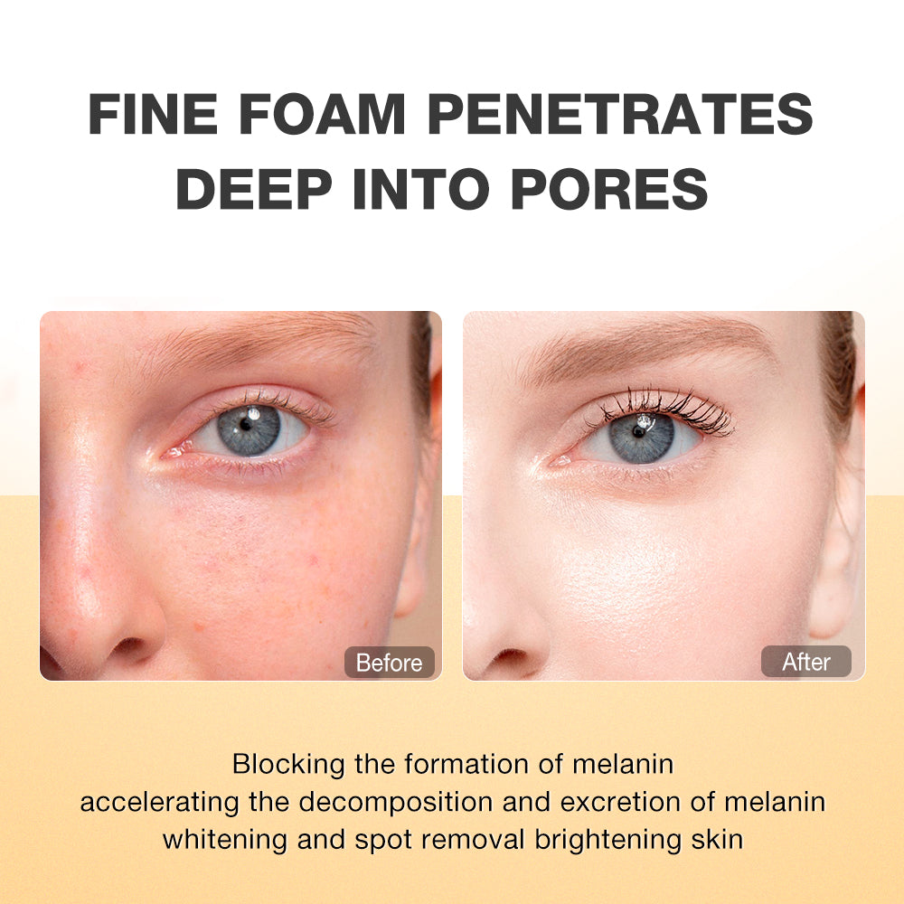 SKINEVER Vitamin C Brightening Facial Cleanser – Glow Boosting Daily Face Wash UAE