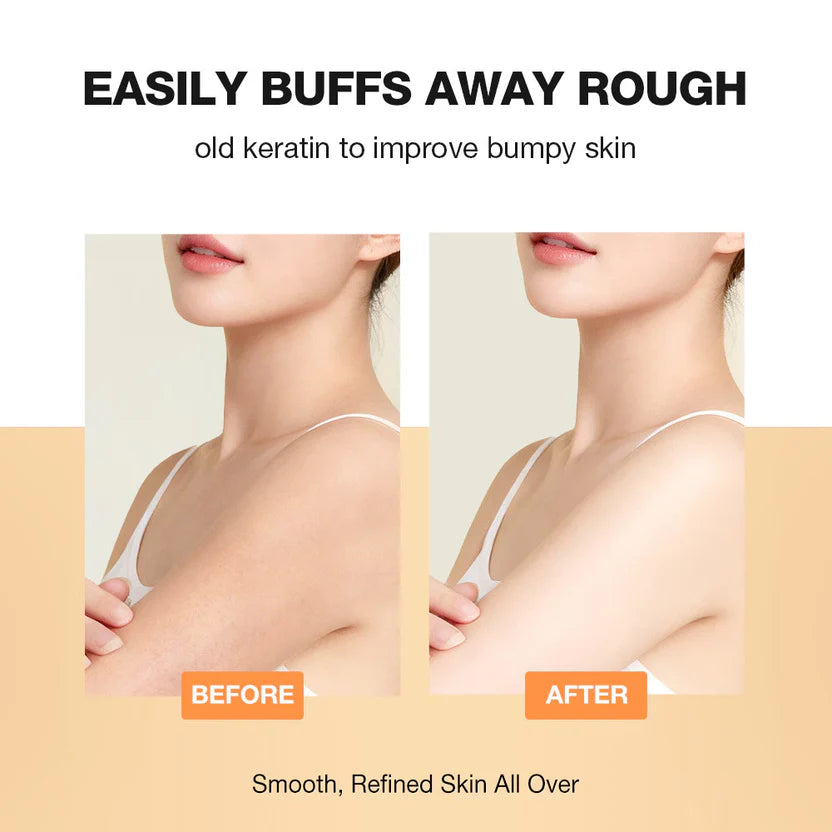 SKINEVER Salicylic Acid Gentle Exfoliating Body Scrub – Deep Cleansing & Smooth Skin UAE